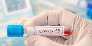 2 Tambahan Kasus Positif Covid-19, 3 Dinyatakan Sembuh