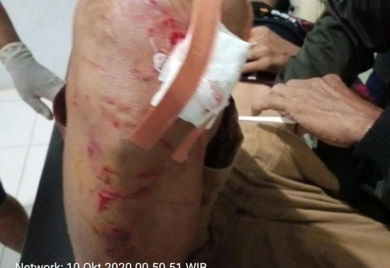Adu Kambing, 3 Orang Warga Seluma Alami Luka Berat